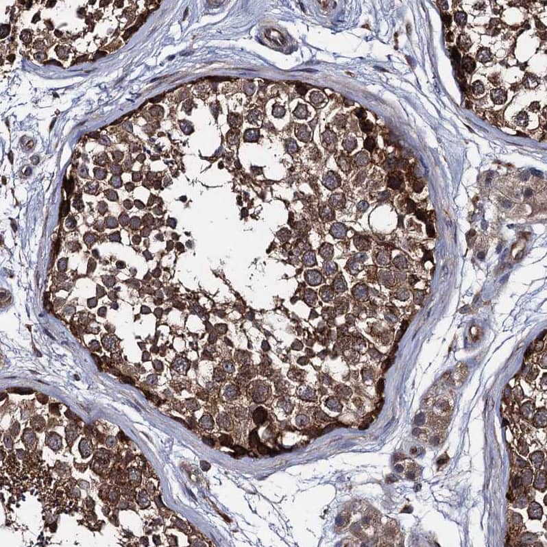 Staining of human testis shows strong cytoplasmic positivity in cells in seminiferous ducts.