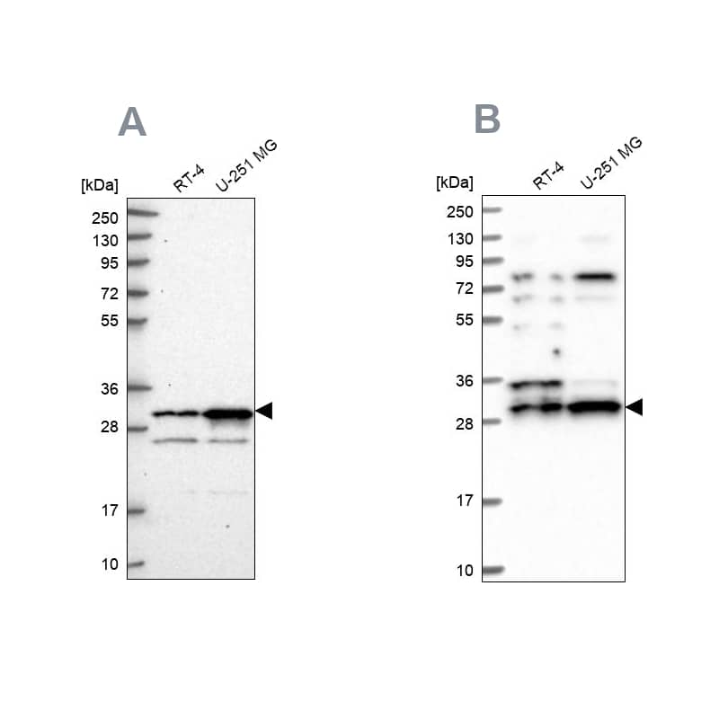Analysis using Anti-HAUS1 antibody NBP1-88159 (A) shows similar pattern to independent antibody NBP1-88158 (B).