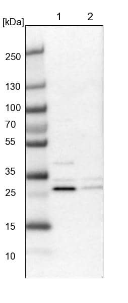 Lane 1: NIH-3T3 cell lysate (Mouse embryonic fibroblast cells)Lane 2: NBT-II cell lysate (Rat Wistar bladder tumour cells)
