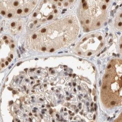 Staining of human kidney.