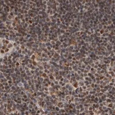 Staining of human lymph node.