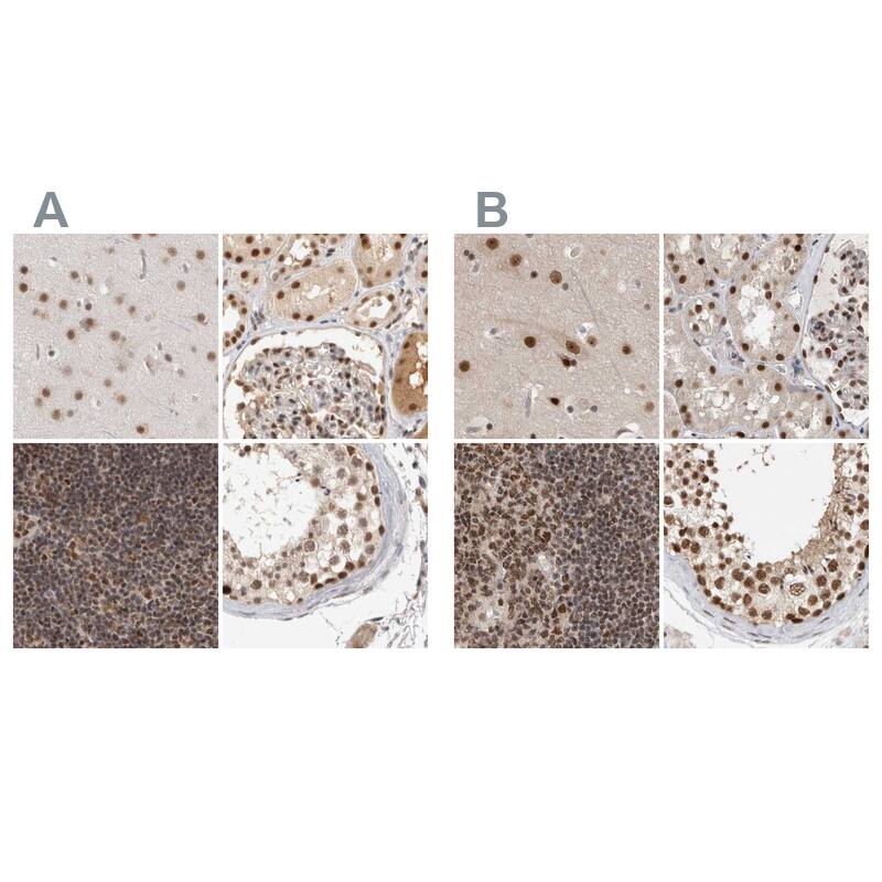 <b>Orthogonal Strategies Validation. </b>Staining of human cerebral cortex, kidney, lymph node and testis HPA024754 (A) shows similar protein distribution across tissues to independent antibody HPA027211 (B).