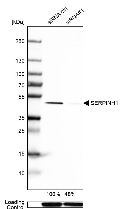 <b>Genetic Strategies Validation. </b>Analysis in Caco-2 cells transfected with control siRNA, target specific siRNA probe #1, using Anti-SERPINH1 antibody. Remaining relative intensity is presented. Loading control: Anti-GAPDH.