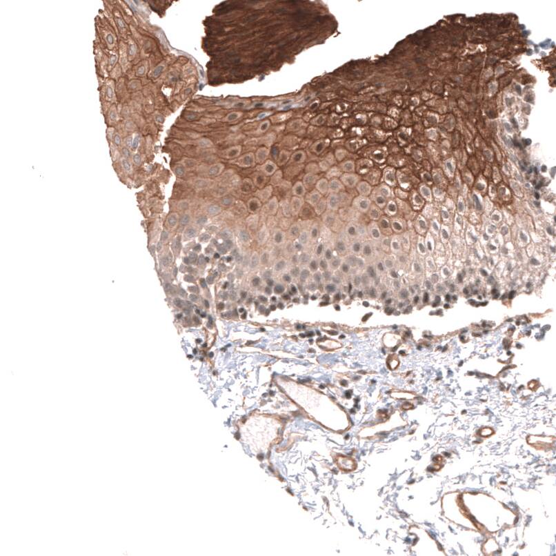 Staining of human urothelium shows moderate to strong membranous positivity in squamous epithelial cells.