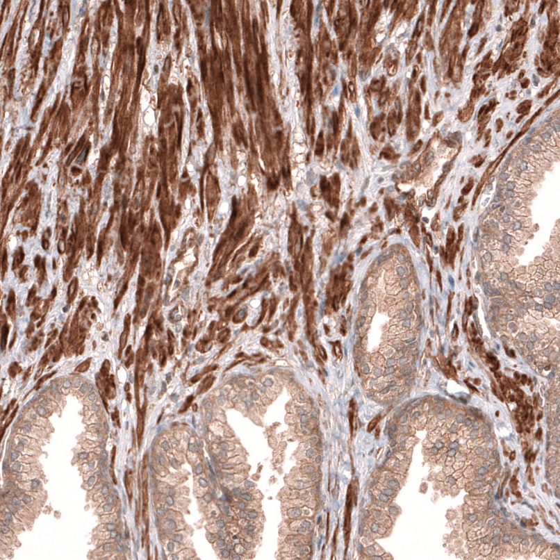 Staining of human prostate shows moderate to strong membranous and cytoplasmic positivity in smooth muscle cells.