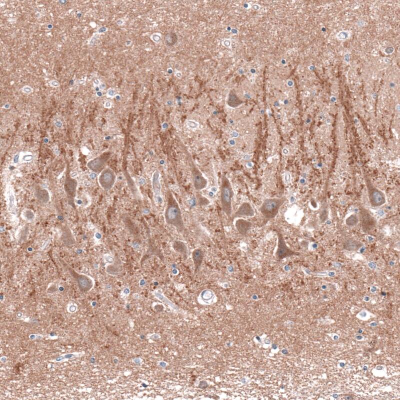 Staining of human hippocampus shows moderate membranous positivity in CA1 neurons.