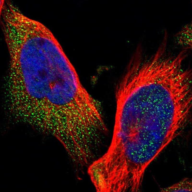 Immunocytochemistry/ Immunofluorescence ELKS Antibody - BSA Free