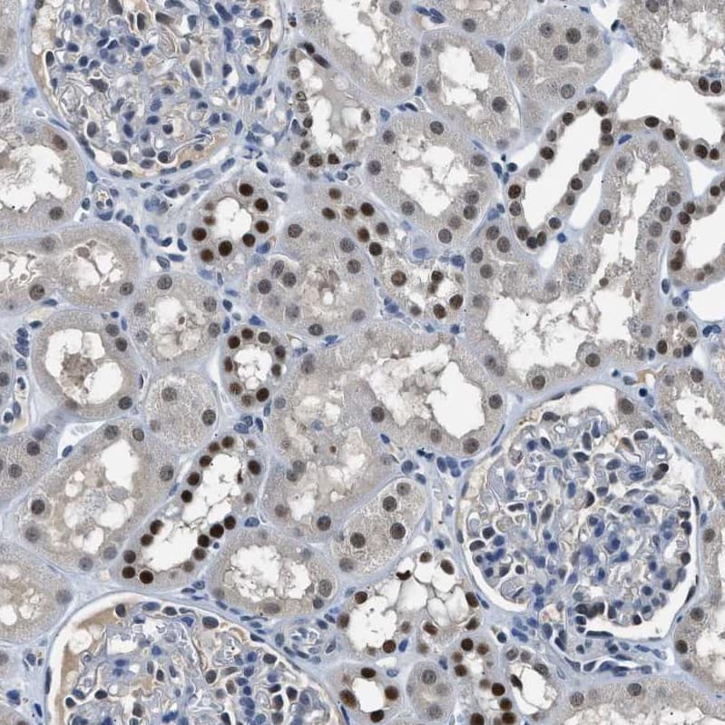 Immunohistochemistry-Paraffin CART1 Antibody - BSA Free