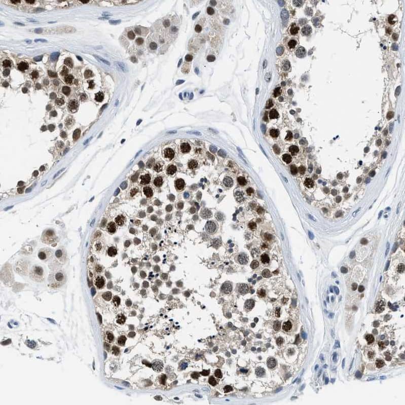 Immunohistochemistry-Paraffin CART1 Antibody - BSA Free