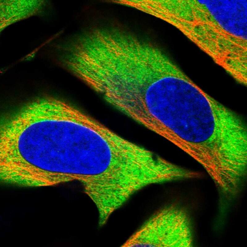 Staining of human cell line U-2 OS shows localization to cytosol.