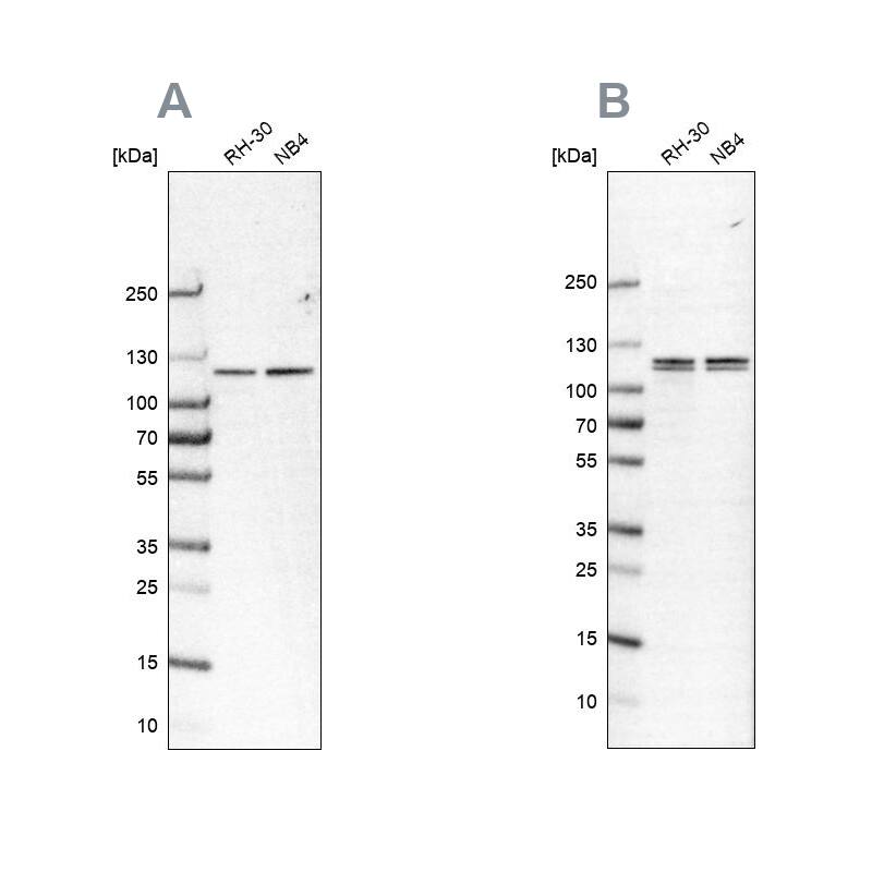 Analysis using NBP1-88195 (A) shows similar pattern to independent antibody NBP2-57388 (B).