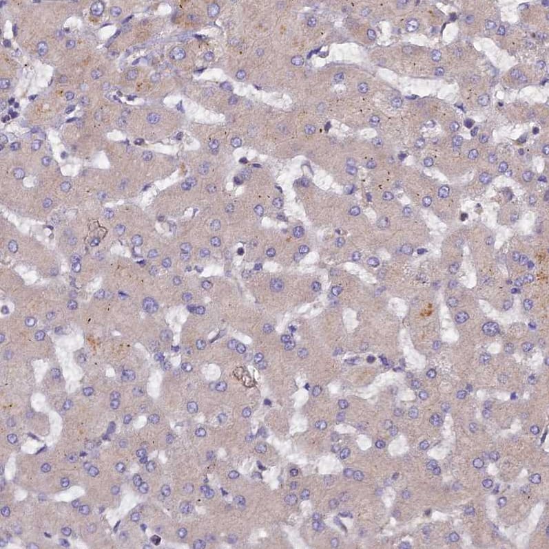 Immunohistochemistry-Paraffin HCAP-G Antibody - BSA Free