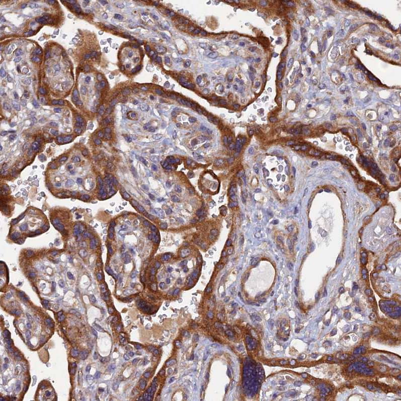 Immunohistochemistry-Paraffin HCAP-G Antibody - BSA Free