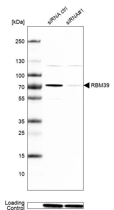 <b>Genetic Strategies Validation. </b>Analysis in Caco-2 cells transfected with control siRNA, target specific siRNA probe #1, using Anti-RBM39 antibody. Remaining relative intensity is presented. Loading control: Anti-GAPDH.