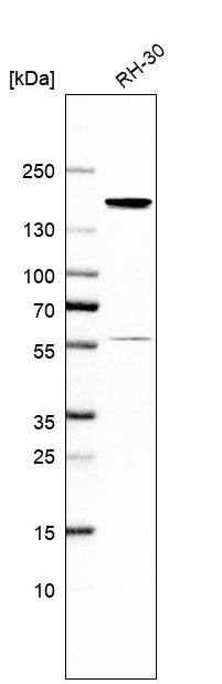 Analysis in human cell line RH-30.