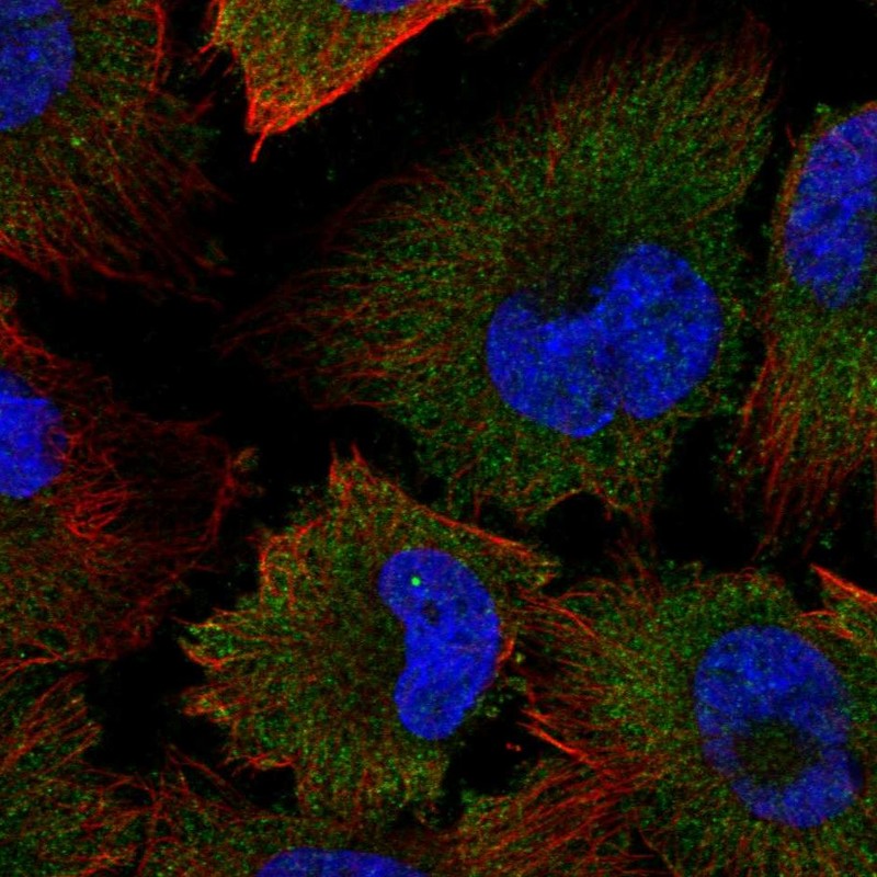 Staining of human cell line U-251 MG shows localization to cytosol.
