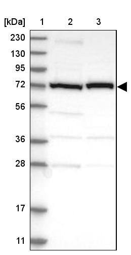Lane 1: Marker [kDa] 230, 130, 95, 72, 56, 36, 28, 17, 11Lane 2: Human cell line RT-4Lane 3: Human cell line U-251MG sp