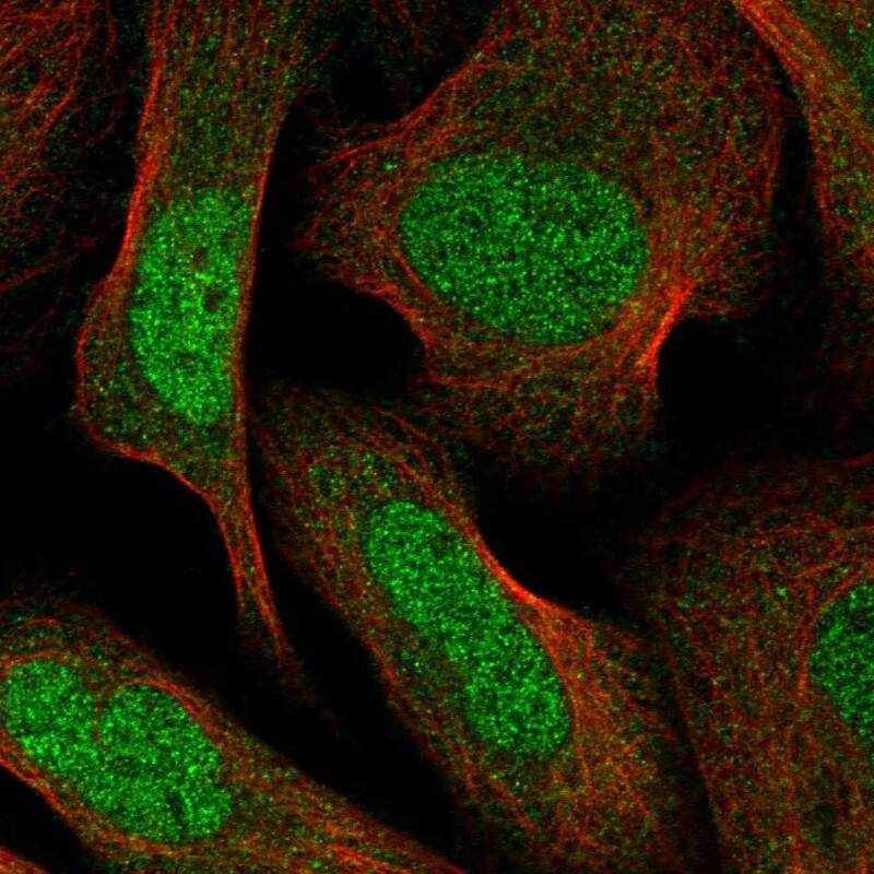 Immunocytochemistry/ Immunofluorescence Protein phosphatase 1F Antibody - BSA Free