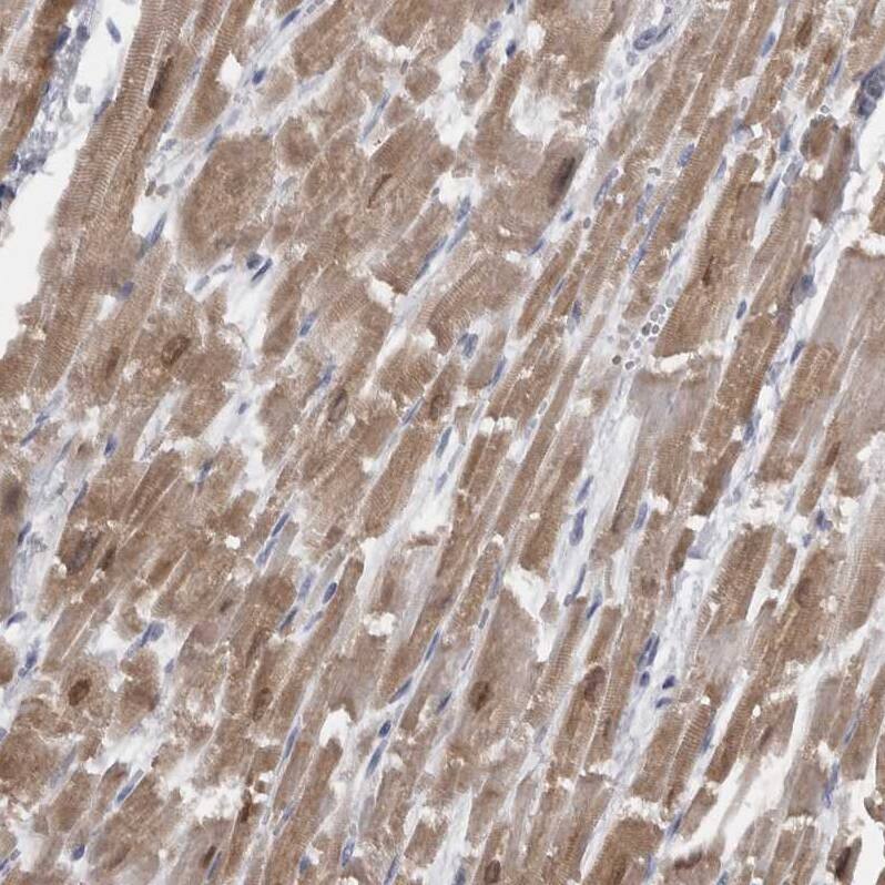 Staining of human heart muscle shows moderate cytoplasmic positivity in cardiomyocytes.