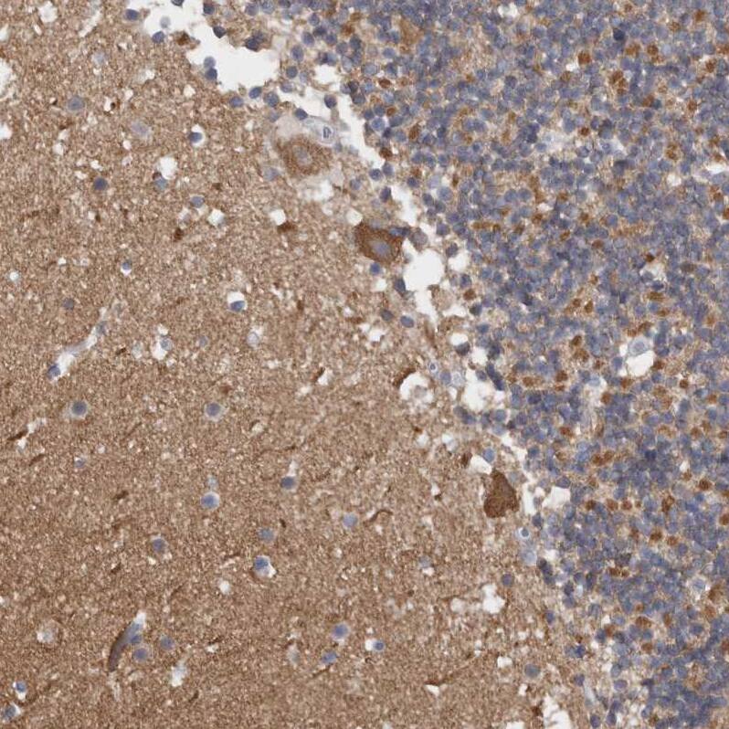 Staining of human cerebellum shows moderate cytoplasmic positivity in Purkinje cells.
