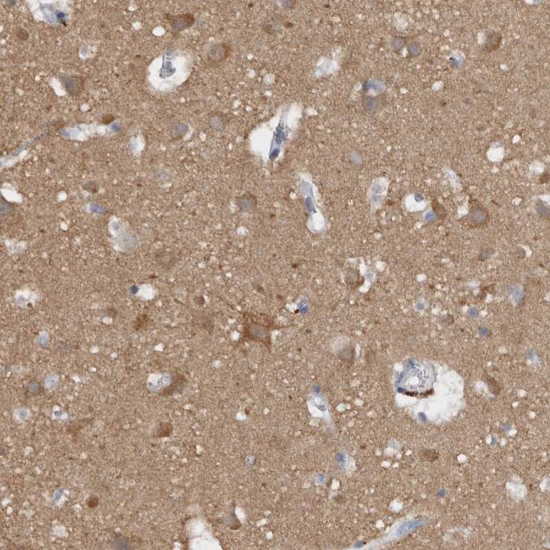 Staining of human cerebral cortex shows moderate cytoplasmic positivity in neuropil and neurons.