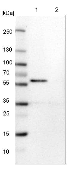 Lane 1: NIH-3T3 cell lysate (Mouse embryonic fibroblast cells)Lane 2: NBT-II cell lysate (Rat Wistar bladder tumour cells)