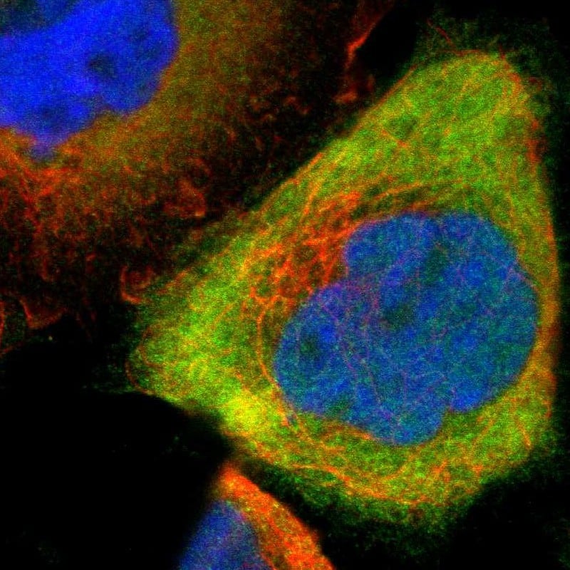 Staining of human cell line A-431 shows localization to cytosol.
