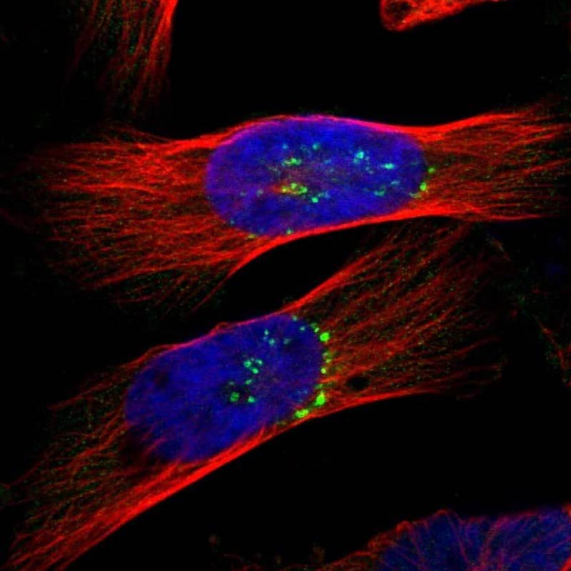 Staining of human cell line U-251 MG shows localization to the Golgi apparatus.