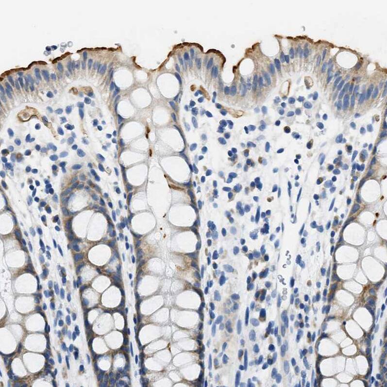 Staining of human rectum shows strong positivity in apical membrane in glandular cells.