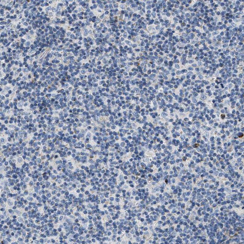 Staining of human lymph node shows no positivity in non-germinal center cells as expected.