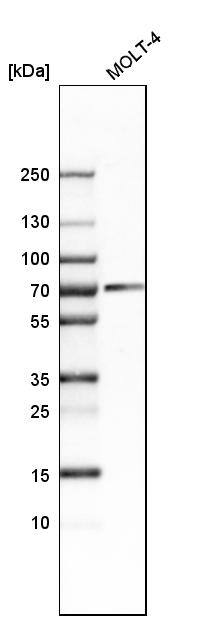 Analysis in human cell line MOLT-4.