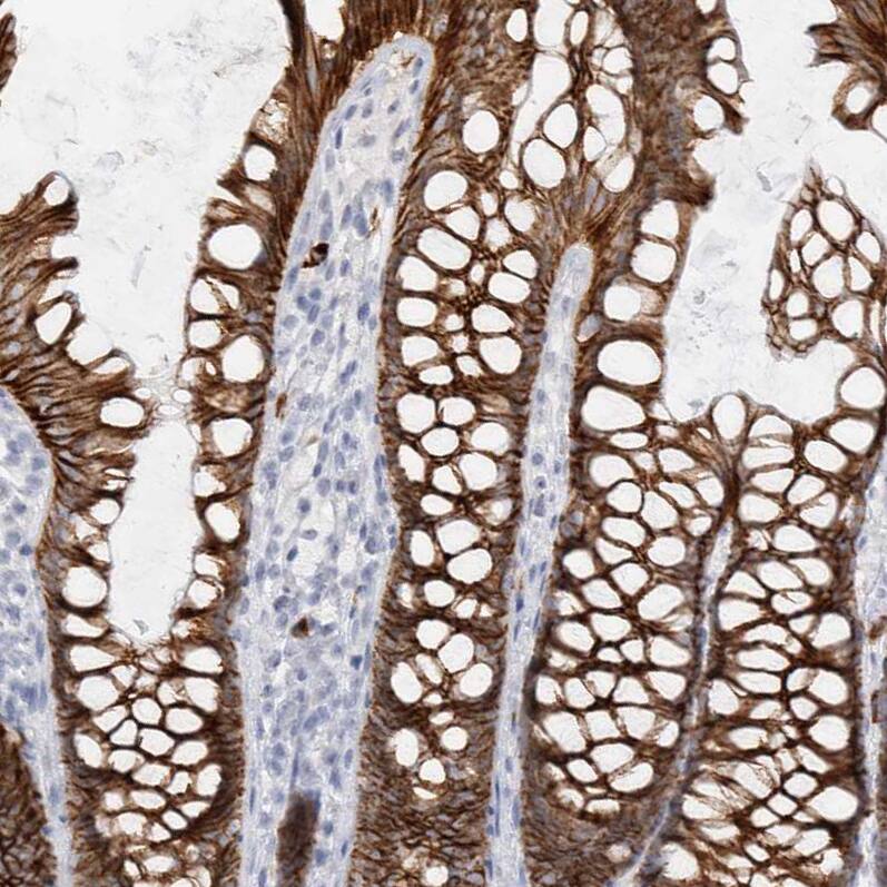 Staining of human colon shows strong membranous positivity in glandular cells.