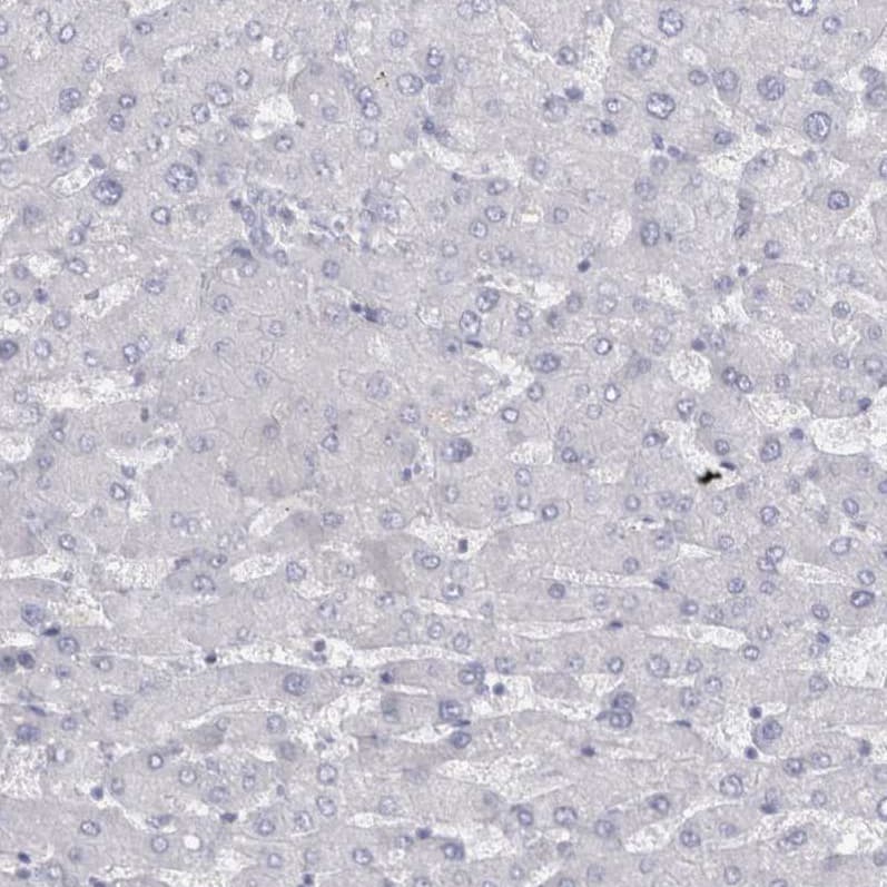 Staining of human liver shows no positivity in hepatocytes as expected.