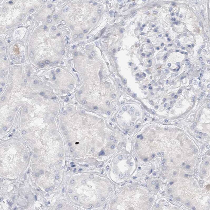 Staining of human kidney shows no positivity in cells in tubules as expected.