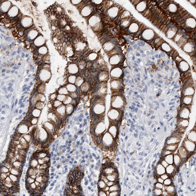 Staining of human colon shows strong membranous positivity in glandular cells.