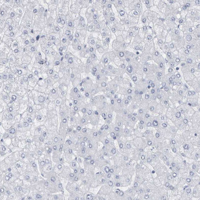 Staining of human liver shows no positivity in hepatocytes as expected.