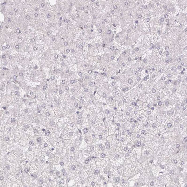 Staining of human liver shows no positivity in hepatocytes as expected.