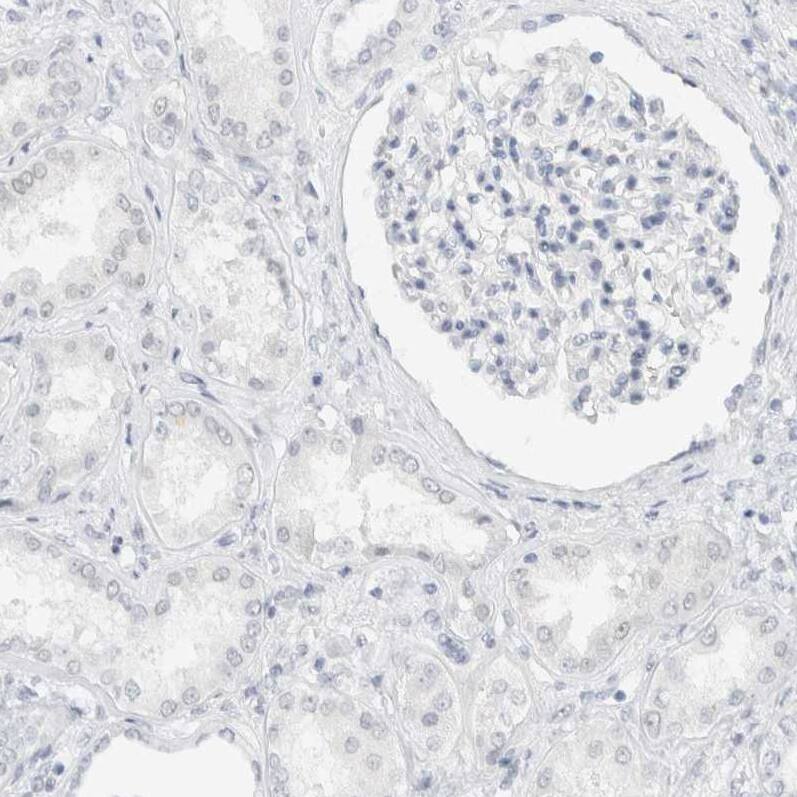 Staining of human kidney shows no positivity in cells in tubules as expected.