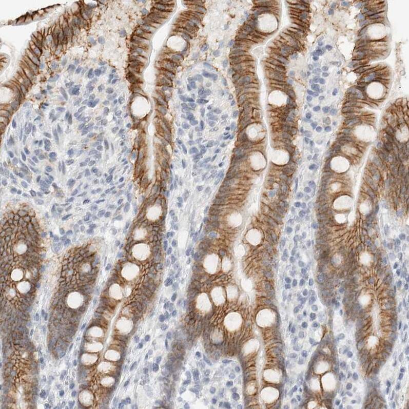 Staining of human duodenum shows strong membranous positivity in glandular cells.