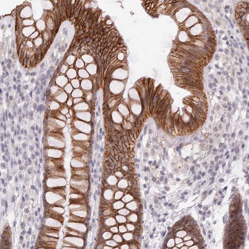 Staining of human colon shows strong membranous positivity in glandular cells.