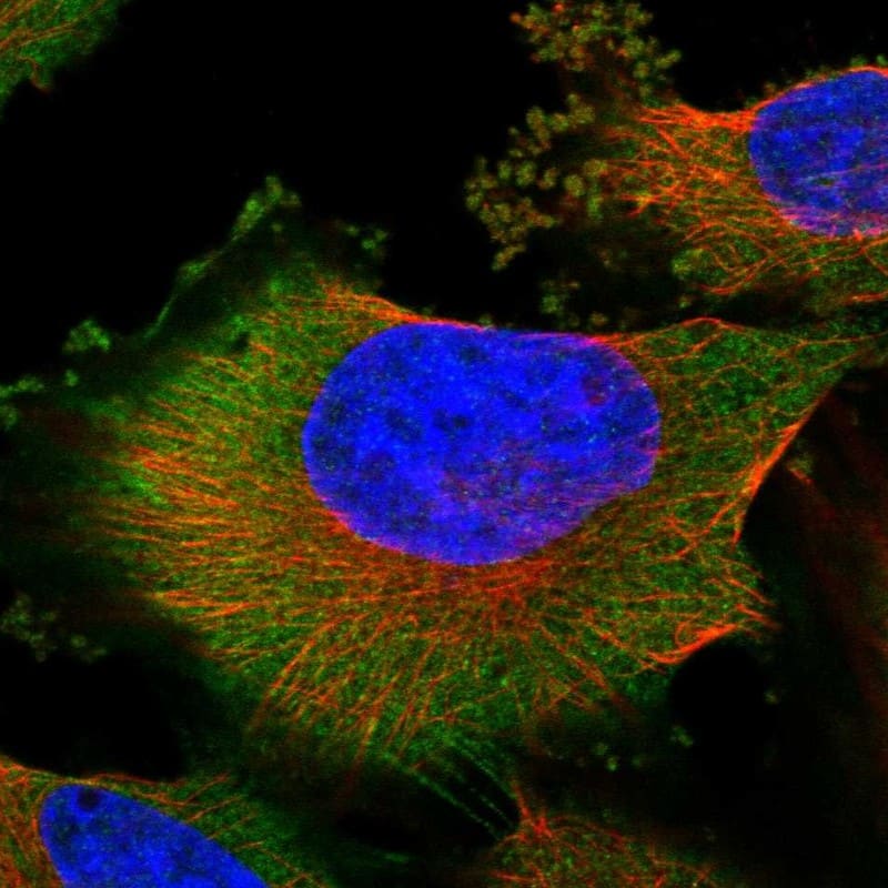 Immunocytochemistry/ Immunofluorescence CGI 62 Antibody - BSA Free
