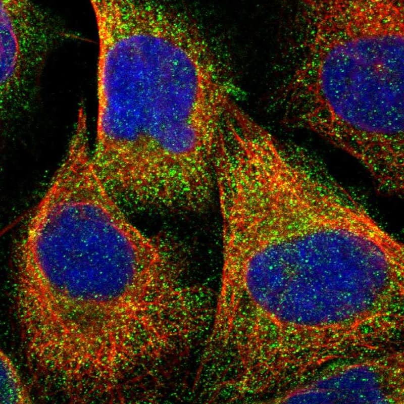 Staining of human cell line U-2 OS shows localization to cytosol.