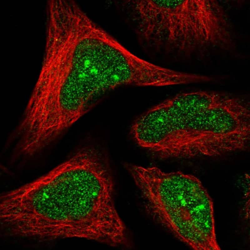 Staining of human cell line U-2 OS shows localization to nucleus & nucleoli.