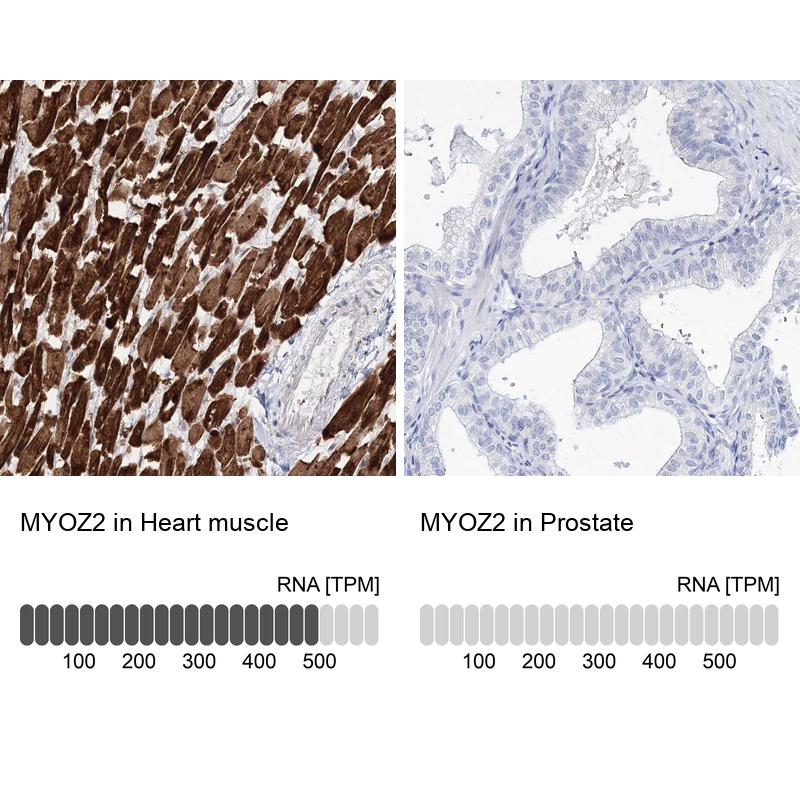 Analysis in human heart muscle and prostate tissues using Anti-MYOZ2 antibody. Corresponding MYOZ2 RNA-seq data are presented for the same tissues.