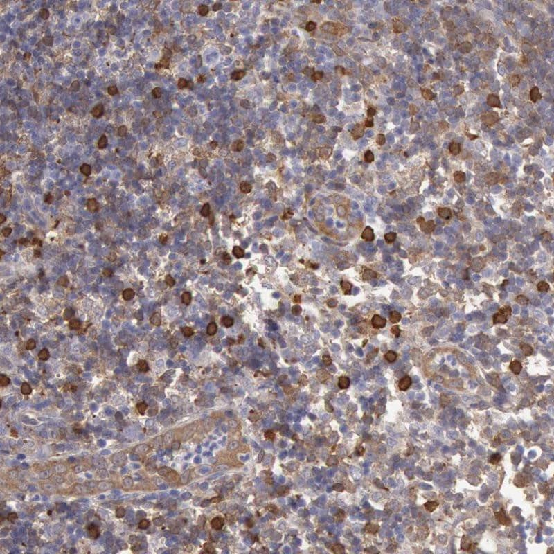 Staining of human lymph node shows strong cytoplasmic positivity in a subset of lymphoid cells outside reaction center.