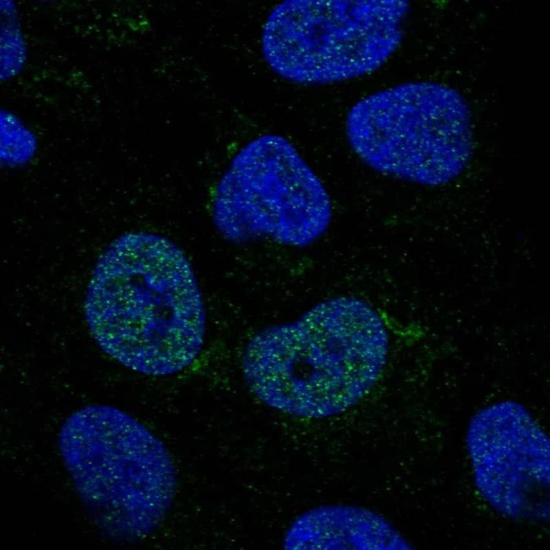 Immunocytochemistry/ Immunofluorescence C2GNT3 Antibody - BSA Free