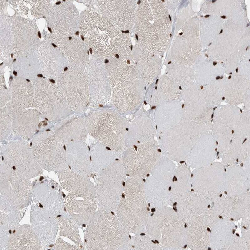 Staining of human skeletal muscle shows strong nuclear and nucleoli positivity in myocytes.