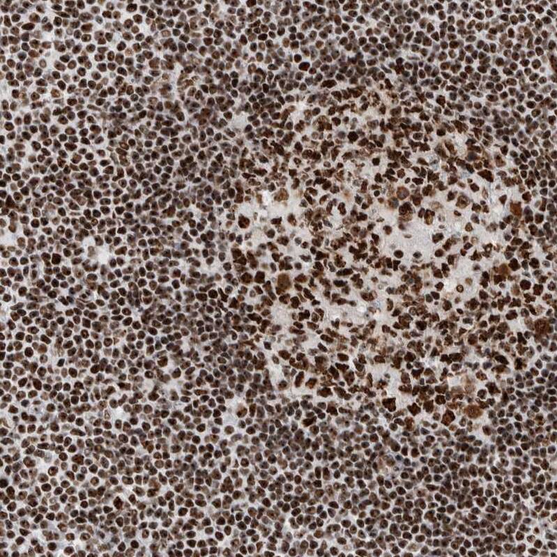 Staining of human lymph node shows strong nuclear and nucleoli positivity in non-germinal center cells and germinal center cells.