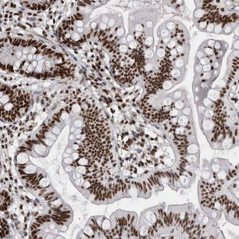 Staining of human small intestine shows strong nuclear and nucleoli positivity in glandular cells and lymphoid cells.