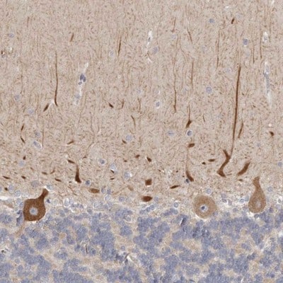 Staining of human cerebellum shows positivity in Purkinje cells, including processes.